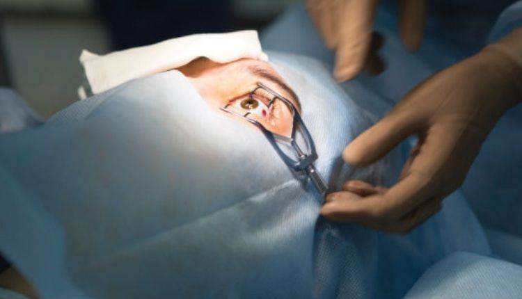 Expectations Following Lasik Surgery