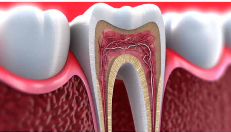 How to Establish a Connection Between Root Canal And Tooth Decay Prevention?